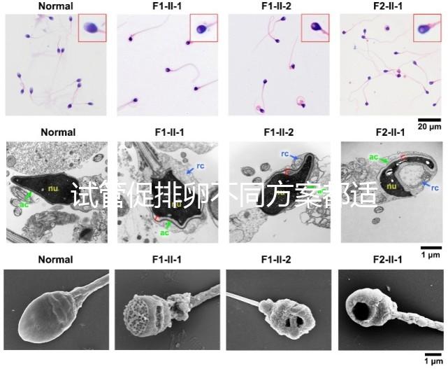 試管促排卵不同方案都適合哪些人？如何監測排卵？