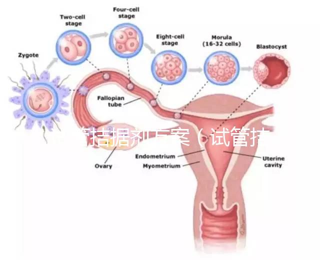 試管拮據(jù)劑方案(試管拮據(jù)劑方案是什么意思)
