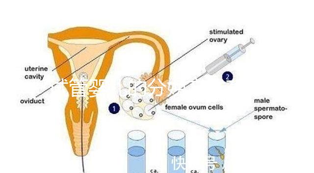 試管嬰兒的分娩方式有哪些？能否自然分娩取決于情況