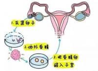 試管嬰兒二超后減藥原因已找到,對胎兒沒影響別瞎擔(dān)心