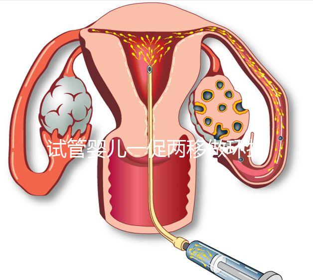 試管嬰兒一促兩移做環(huán)扎好看嗎？小心這些影響