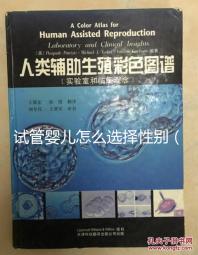 試管嬰兒怎么選擇性別(試管嬰兒怎么選擇性別的)