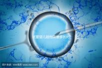 試管嬰兒建檔需要多長(zhǎng)時(shí)間進(jìn)來(lái)瞧，內(nèi)含詳細(xì)流程供參考