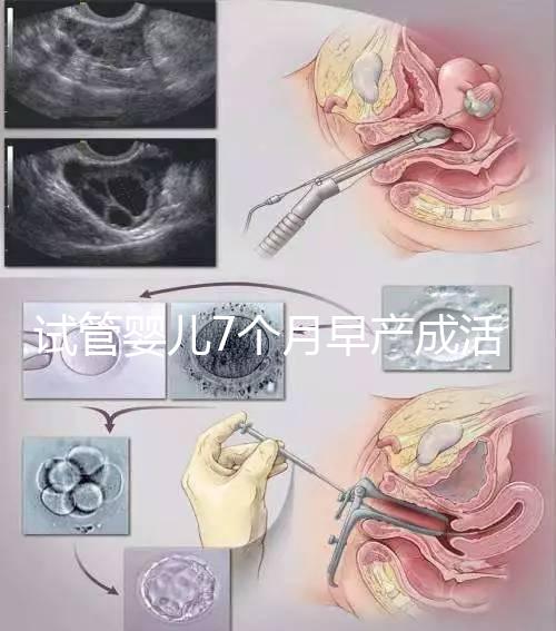 試管嬰兒7個(gè)月早產(chǎn)成活率高達(dá)80%!能不能要看身體狀況