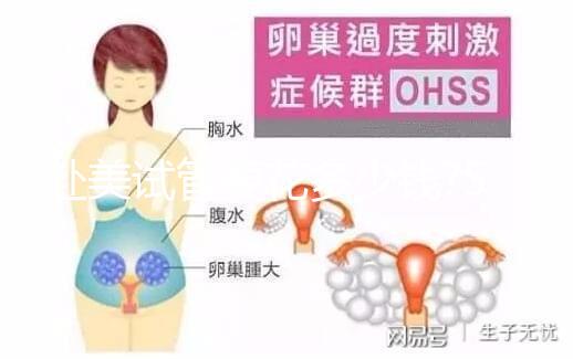 赴美試管要花多少錢?5大收費(fèi)看懂美國試管嬰兒貴在哪里