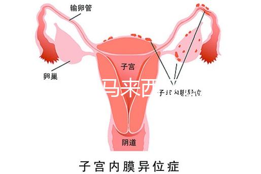 還在糾結馬來西亞試管嬰兒醫(yī)院怎么選擇?讀完這篇文章,不困難