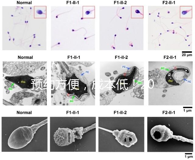 預約方便,成本低!2024年西安新城、臨潼、雁塔四維彩超指南