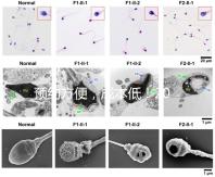 預約方便，成本低！2024年西安新城、臨潼、雁塔四維彩超指南
