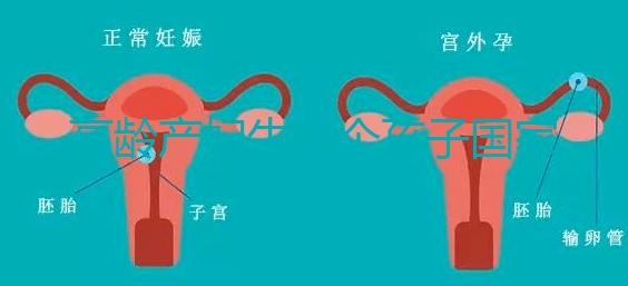 高齡產(chǎn)婦生八個(gè)孩子國家有補(bǔ)助？有沒有違法才是關(guān)鍵