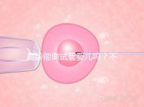 高齡能做試管嬰兒嗎?不是想做就能做得滿足這5個(gè)條件