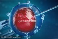 45歲懷孕藥流有風險！這4種并發癥極易影響安全