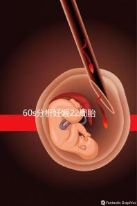 60s分析妊娠22周胎教哪些內(nèi)容比較好,觸摸、光照都有好處