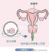 2024年西藏三胎新政策出臺(tái)，拉薩、日喀則產(chǎn)假戳多久？