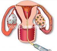 2024武漢免費(fèi)葉酸外國(guó)人可以領(lǐng)取,符合條件就來(lái)江漢區(qū)