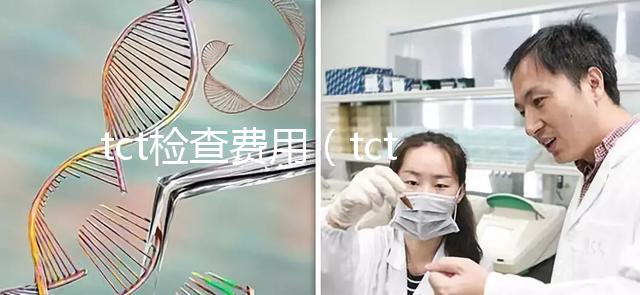 tct檢查費用(tct檢查一般多少錢)
